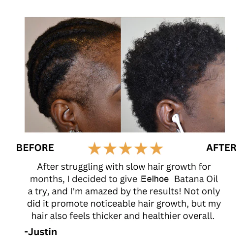 Batana Natural Hair Growth Oil 🇺🇸