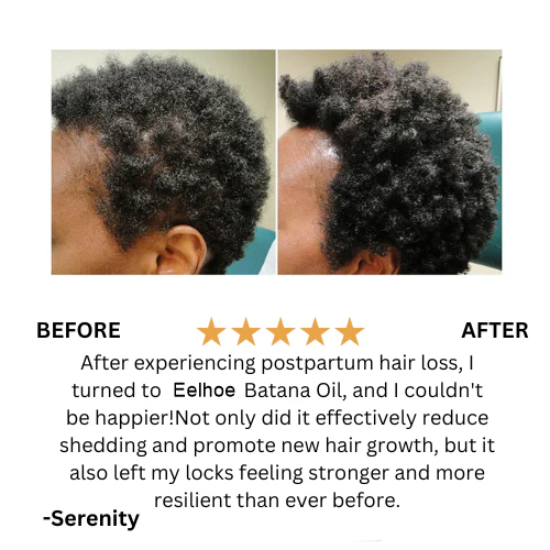 Batana Natural Hair Growth Oil 🇺🇸