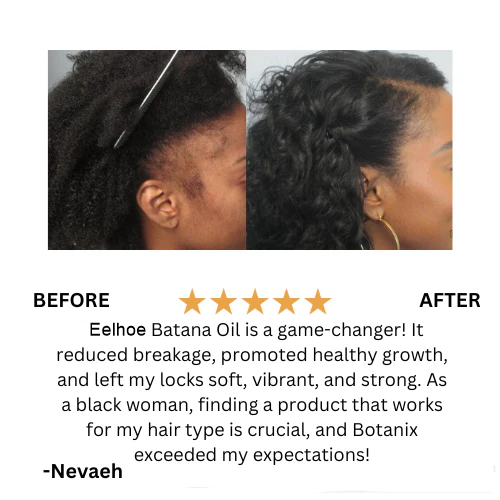 Batana Natural Hair Growth Oil 🇺🇸